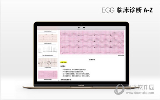 ECG A-Z Pro